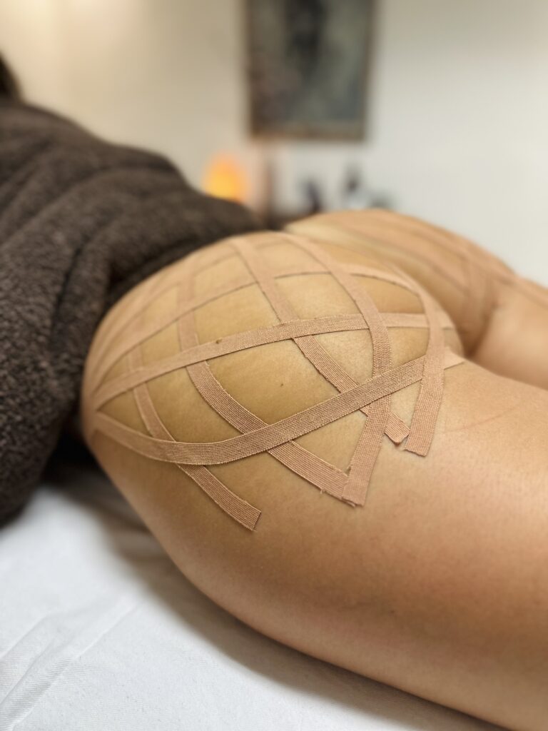 Tratamientos corporales, CT Celulitis Elevador Global 360º. Cristina Torrecilla Centro de Estética en Huesca